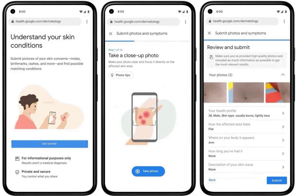Google Health AI tool